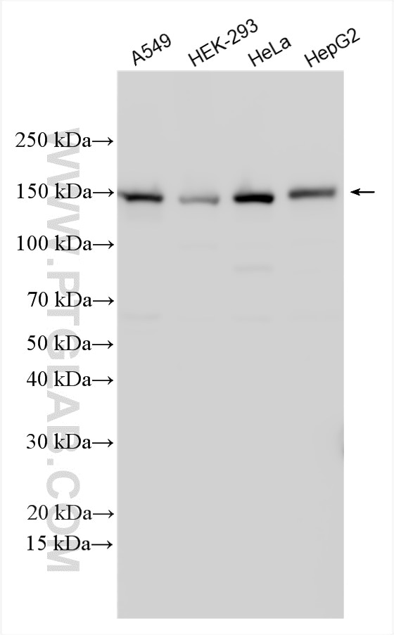 Western Blot (WB) analysis of various lysates using DSG2 Polyclonal antibody (21880-1-AP)
