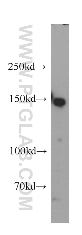 Western Blot (WB) analysis of HEK-293 cells using DSG2 Polyclonal antibody (21880-1-AP)
