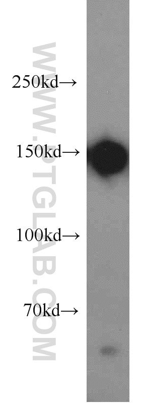 Western Blot (WB) analysis of HepG2 cells using DSG2 Polyclonal antibody (21880-1-AP)