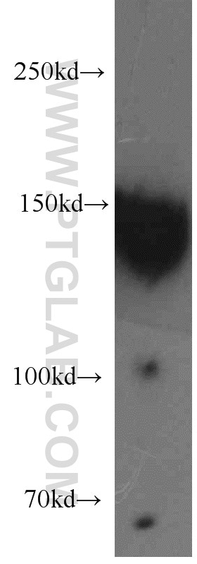 Western Blot (WB) analysis of A431 cells using DSG2 Polyclonal antibody (21880-1-AP)