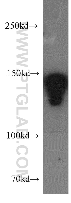 Western Blot (WB) analysis of A549 cells using DSG2 Polyclonal antibody (21880-1-AP)