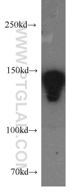 WB analysis of A549 using 21880-1-AP
