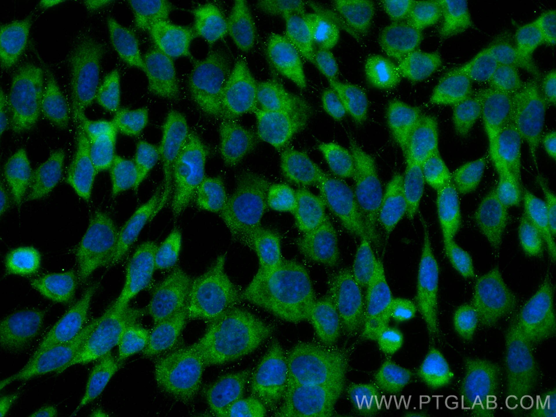 IF Staining of A431 using 29206-1-AP