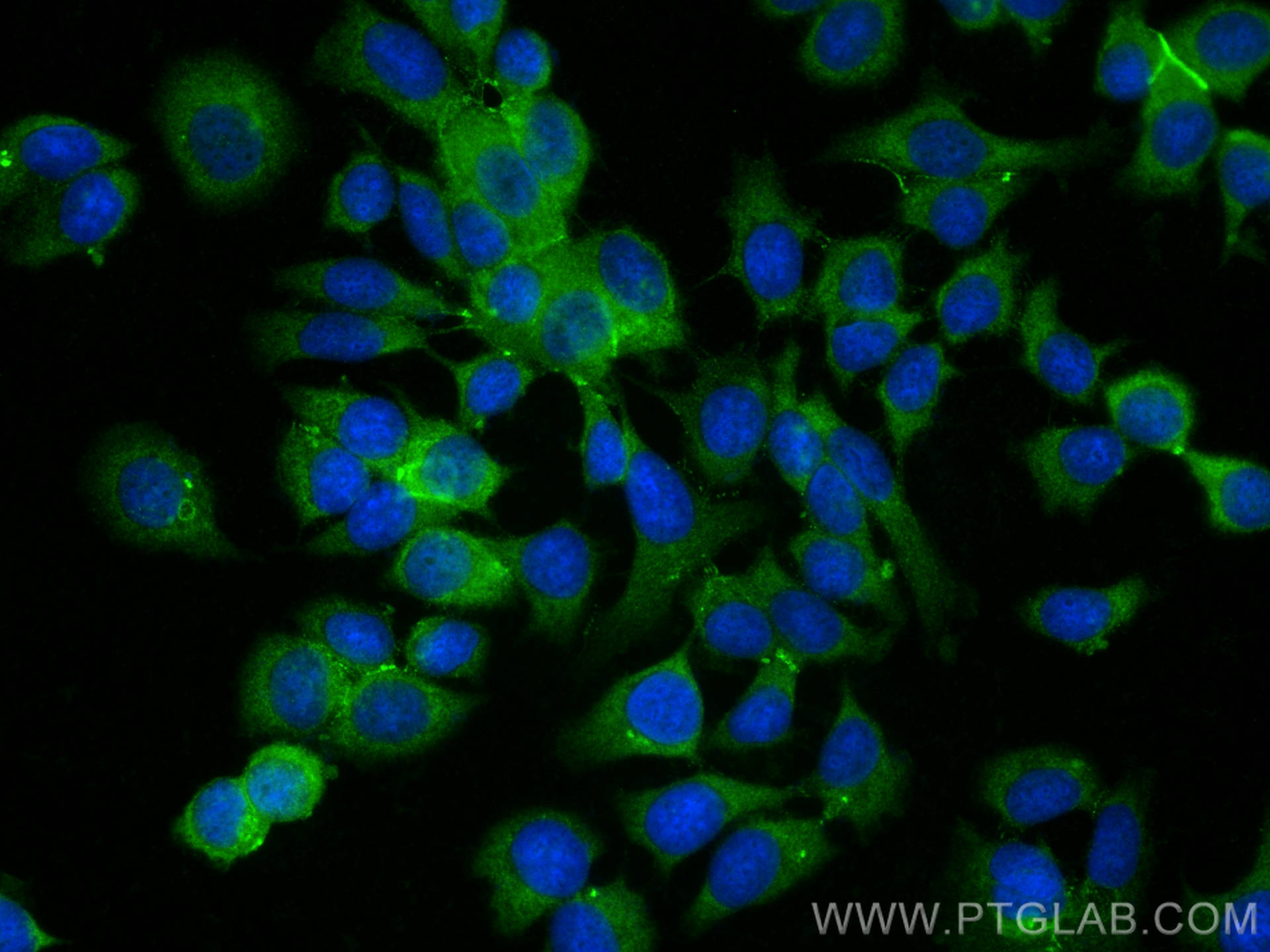 Immunofluorescence (IF) / fluorescent staining of MCF-7 cells using DSG2 Polyclonal antibody (29206-1-AP)