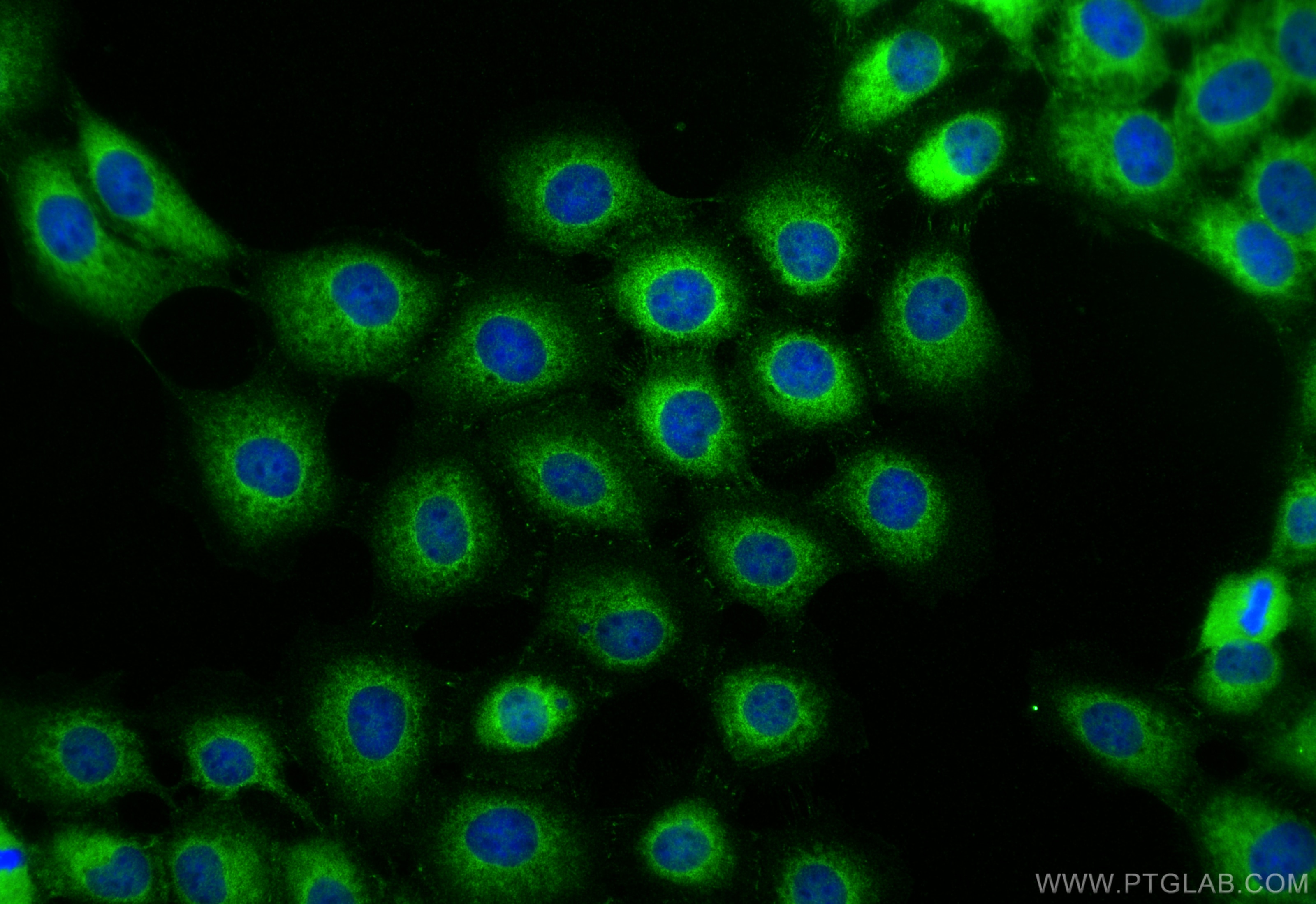 Immunofluorescence (IF) / fluorescent staining of A431 cells using DSG2 Polyclonal antibody (29206-1-AP)