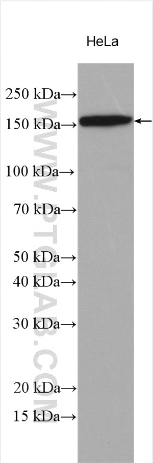 Western Blot (WB) analysis of various lysates using DSG2 Polyclonal antibody (29206-1-AP)