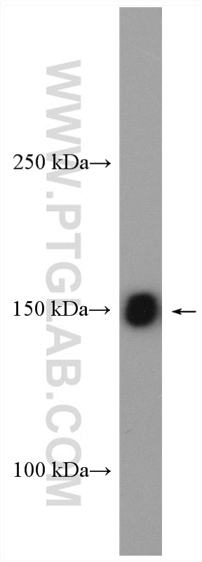 Western Blot (WB) analysis of HEK-293 cells using DSG2 Polyclonal antibody (29206-1-AP)