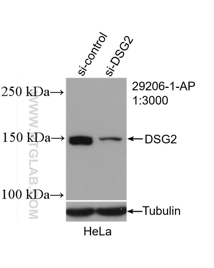 Western Blot (WB) analysis of HeLa cells using DSG2 Polyclonal antibody (29206-1-AP)