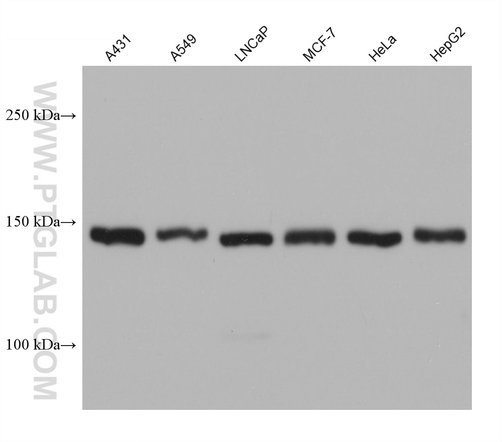 Western Blot (WB) analysis of various lysates using DSG2 Monoclonal antibody (68515-1-Ig)