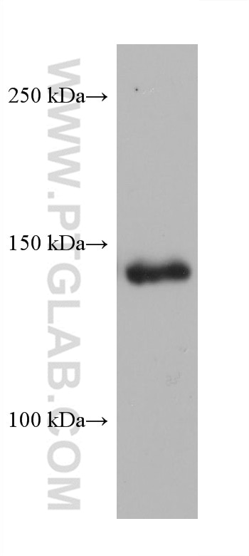 Western Blot (WB) analysis of K-562 cells using DSG2 Monoclonal antibody (68515-1-Ig)