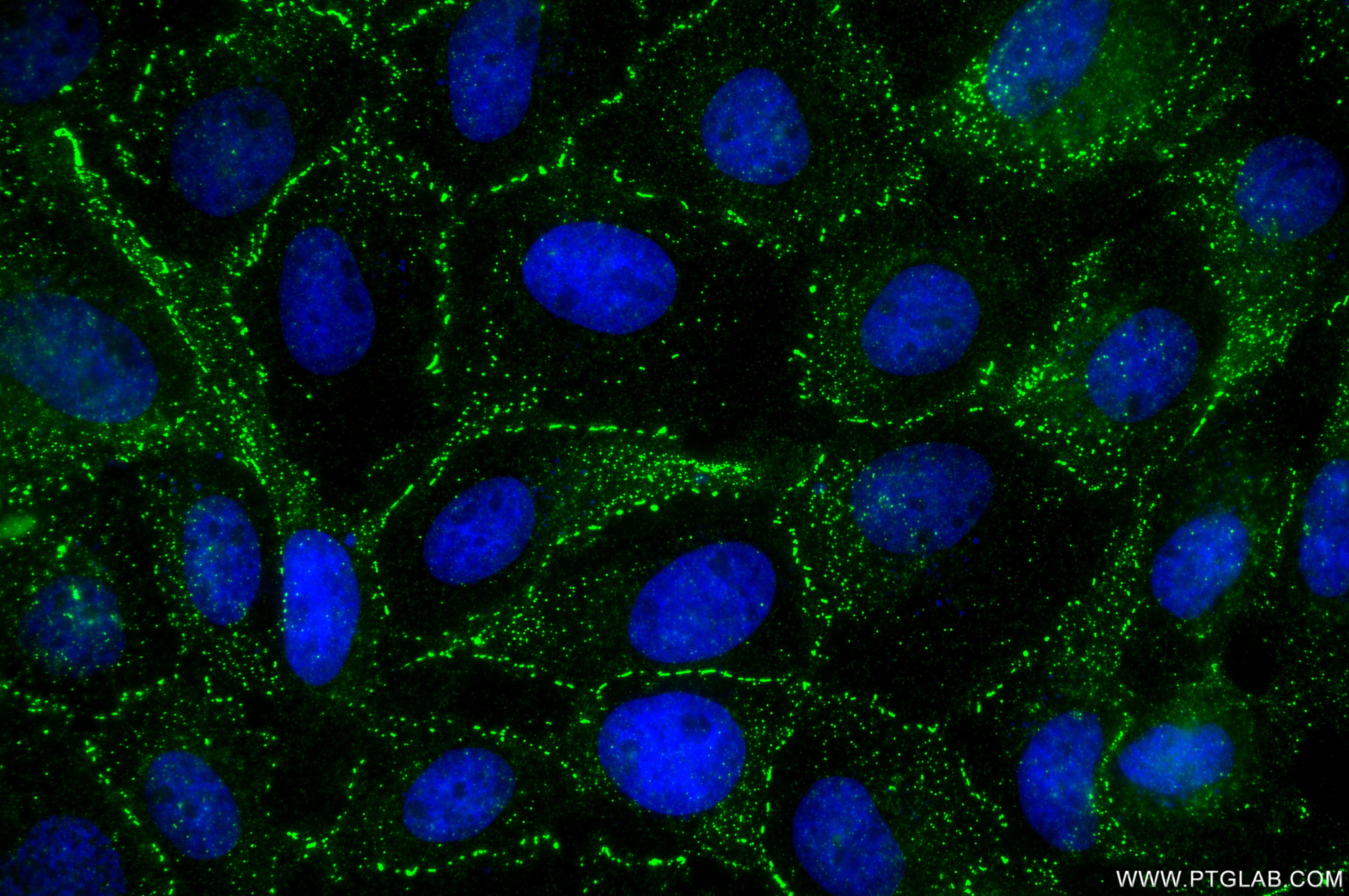 Immunofluorescence (IF) / fluorescent staining of A431 cells using DSG2 Recombinant monoclonal antibody (87426-1-RR)