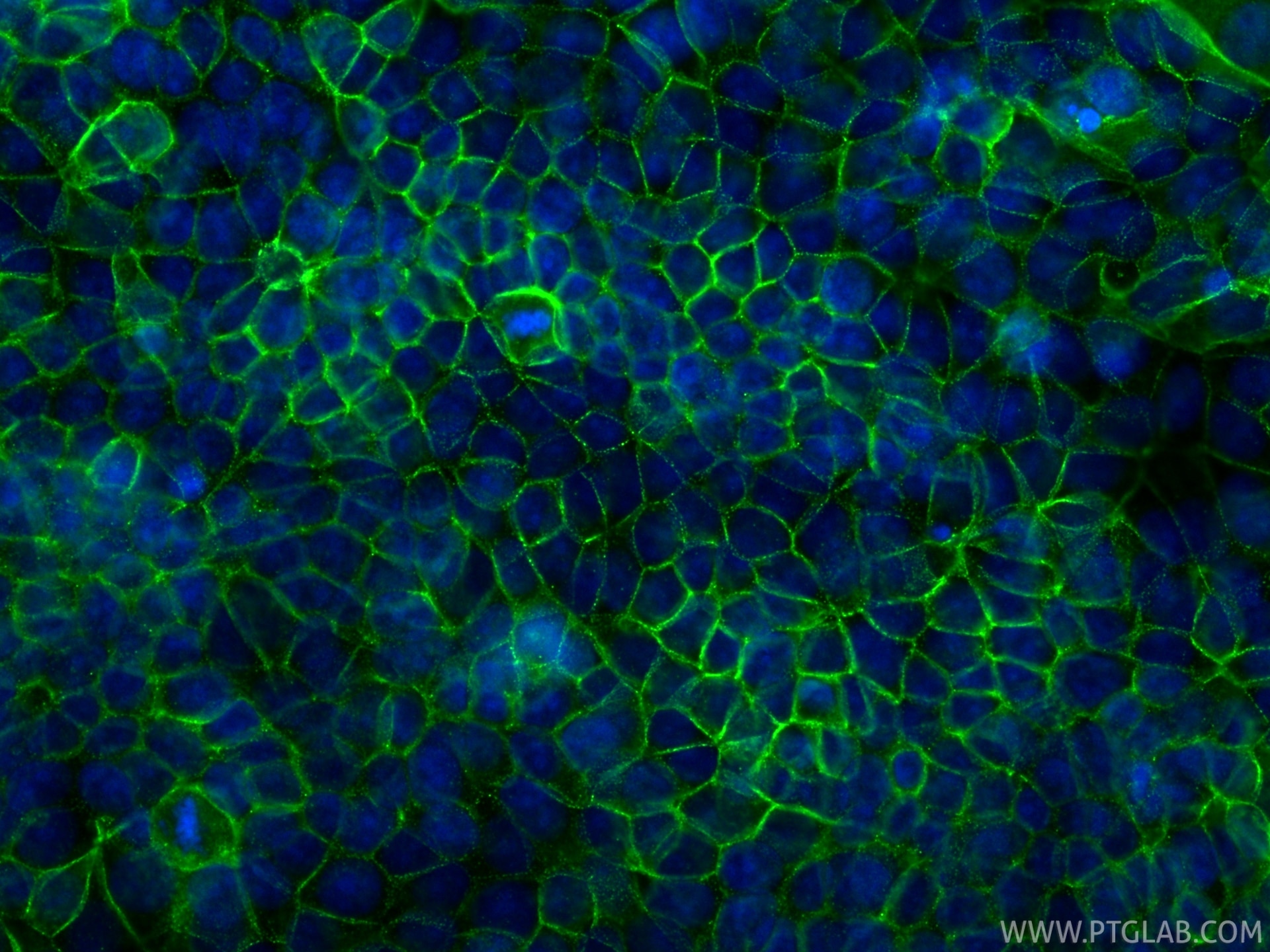 Immunofluorescence (IF) / fluorescent staining of MCF-7 cells using DSG2 Recombinant monoclonal antibody (87426-1-RR)