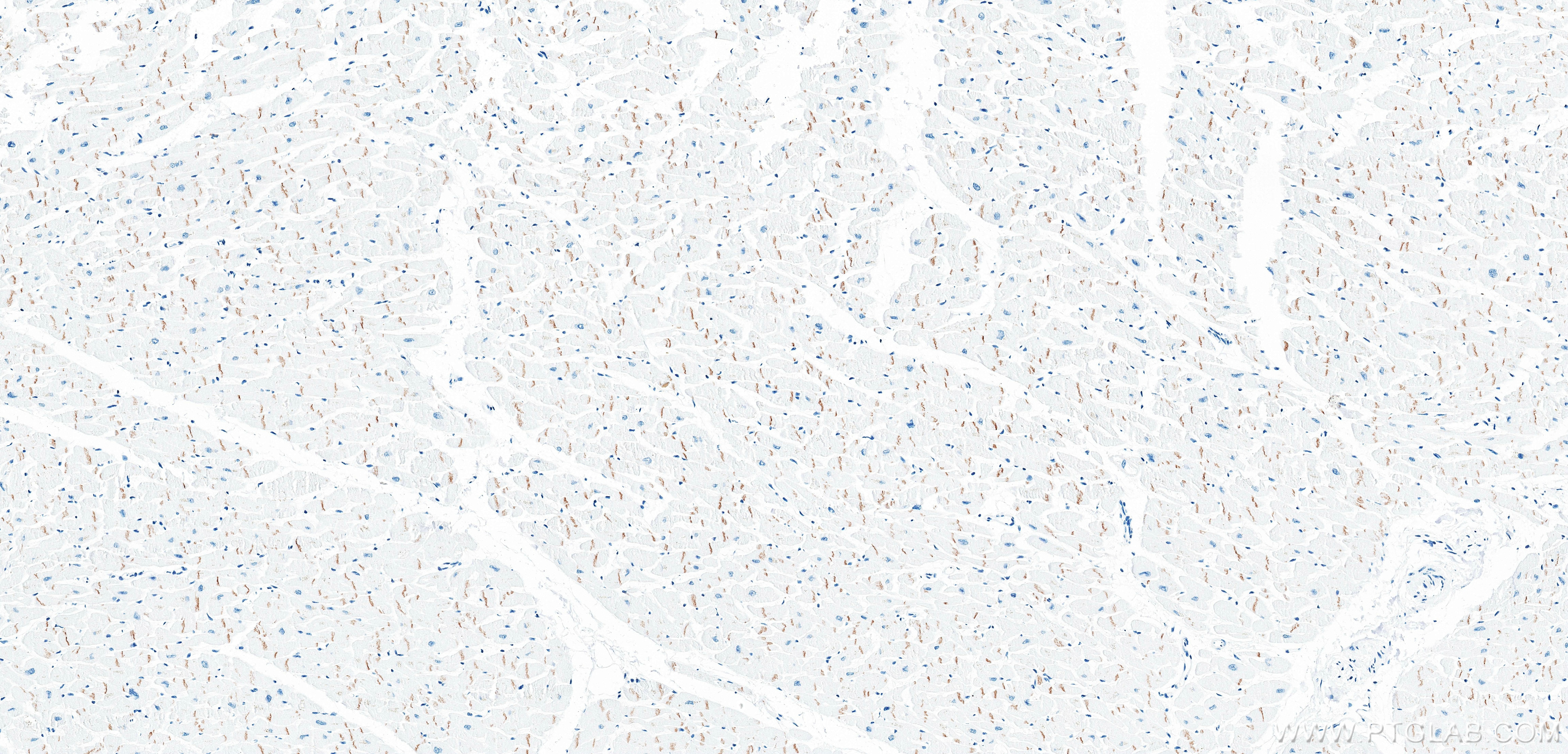 IHC staining of human heart using 87426-1-RR Immunohistochemistry (IHC) staining of human heart tissue using DSG2 Recombinant monoclonal antibody (87426-1-RR)