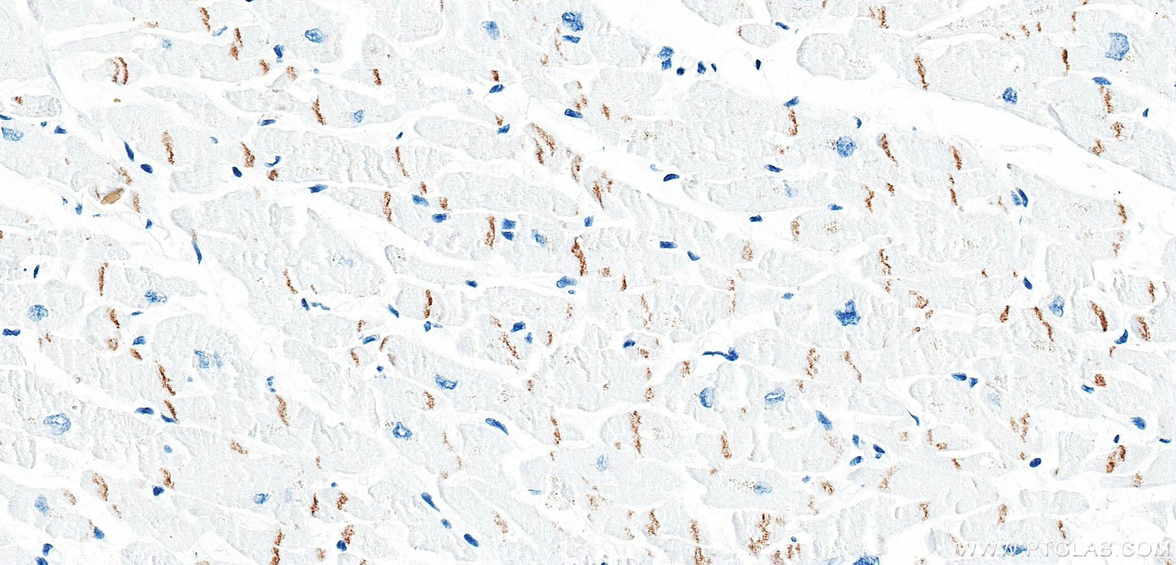 IHC staining of human heart using 87426-1-RR Immunohistochemistry (IHC) staining of human heart tissue using DSG2 Recombinant monoclonal antibody (87426-1-RR)