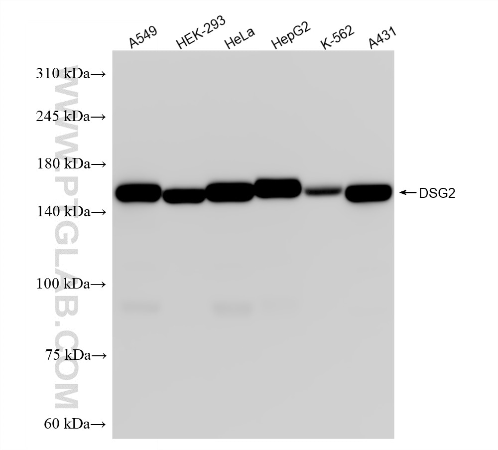 Western Blot (WB) analysis of various lysates using DSG2 Recombinant monoclonal antibody (87426-1-RR)