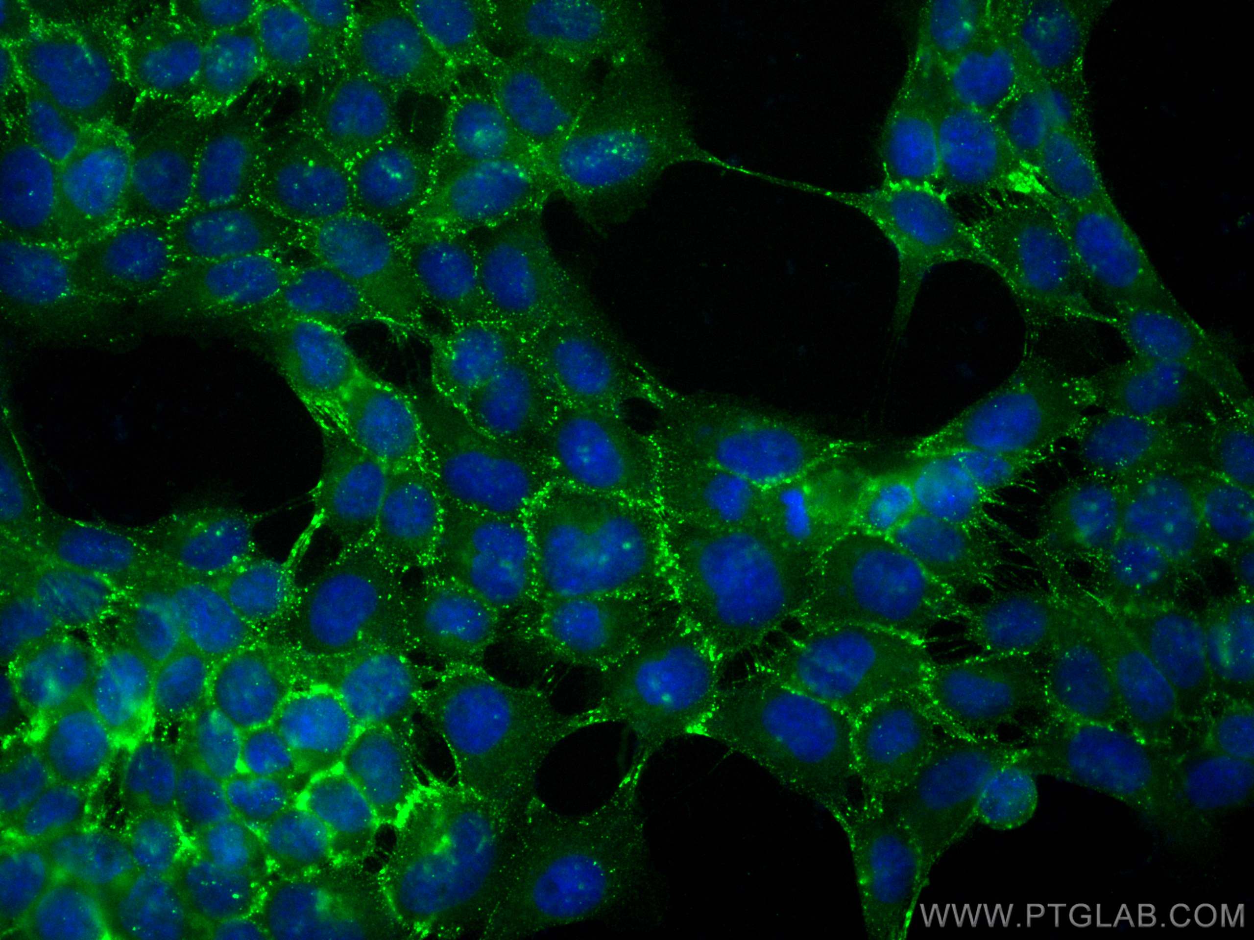 Immunofluorescence (IF) / fluorescent staining of A431 cells using CoraLite® Plus 488-conjugated DSG2 Polyclonal anti (CL488-21880)