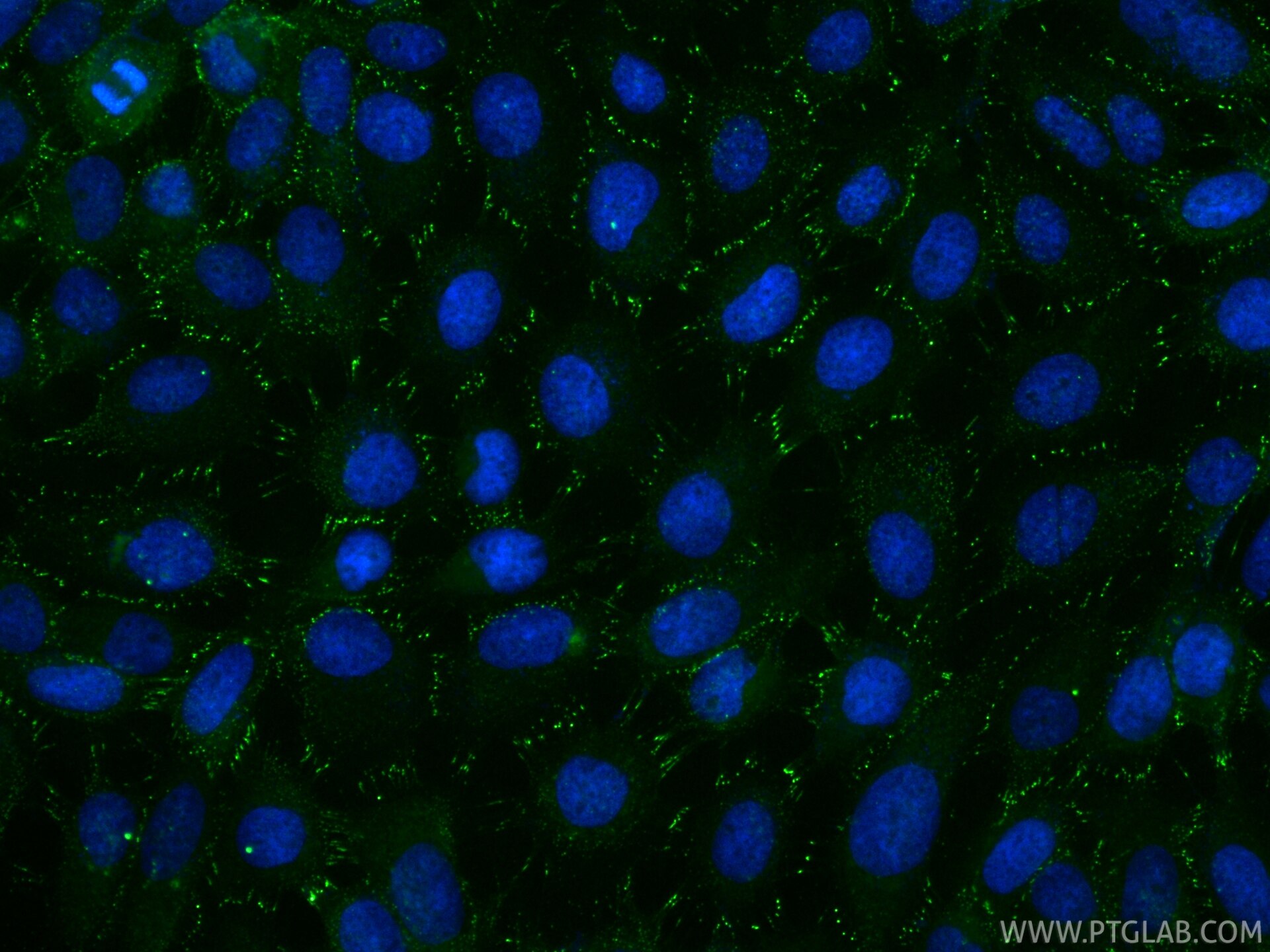 Immunofluorescence (IF) / fluorescent staining of A431 cells using CoraLite® Plus 488-conjugated DSG2 Recombinant mon (CL488-87426)