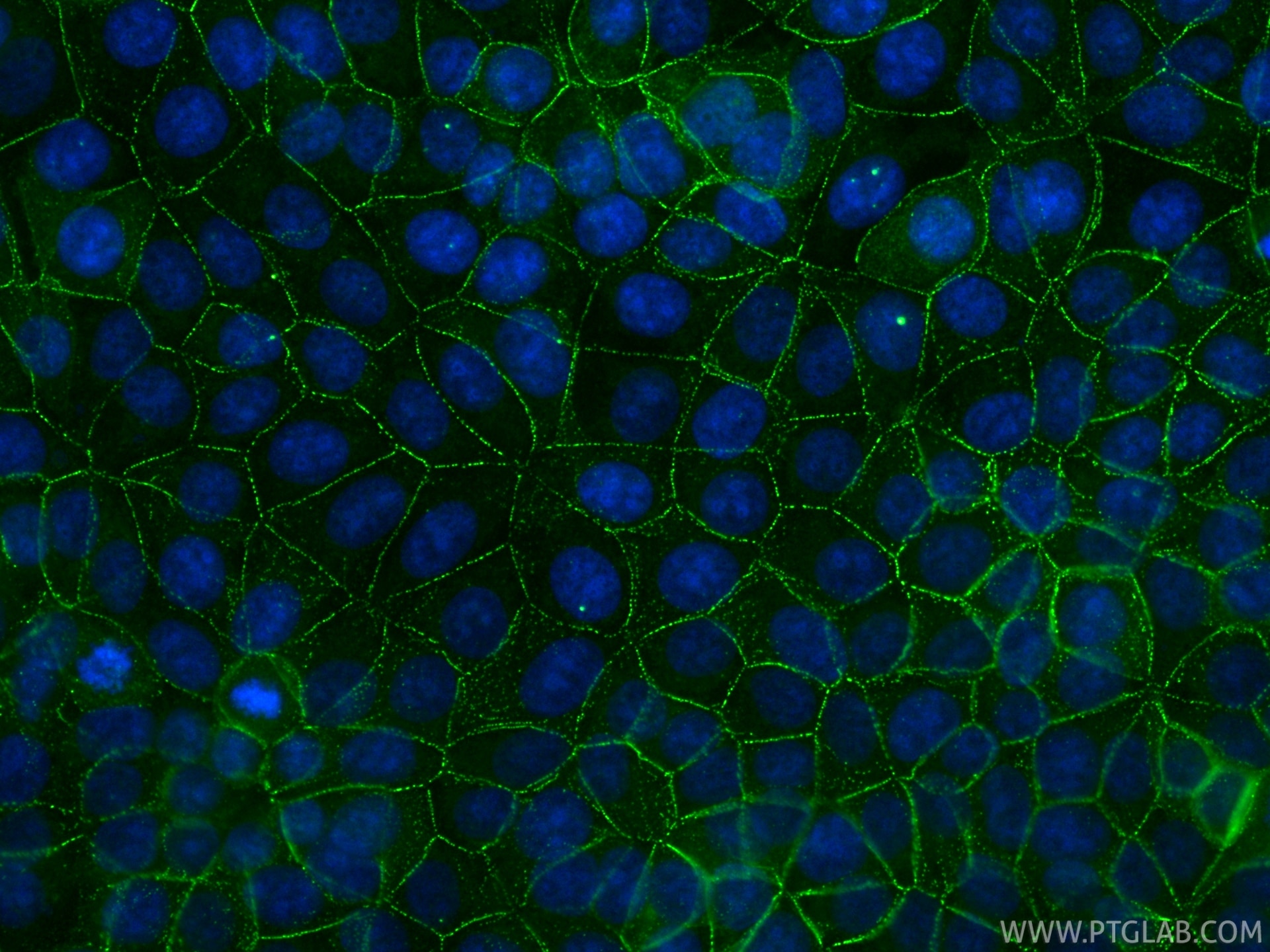 Immunofluorescence (IF) / fluorescent staining of MCF-7 cells using CoraLite® Plus 488-conjugated DSG2 Recombinant mon (CL488-87426)