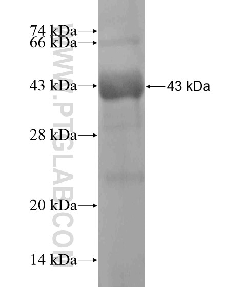 DSG2 fusion protein Ag20633 SDS-PAGE
