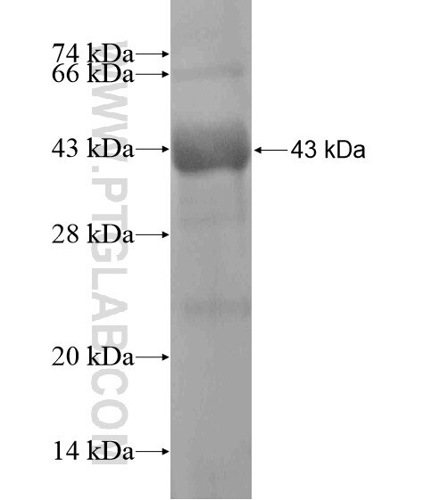 DSG2 fusion protein Ag20633 SDS-PAGE