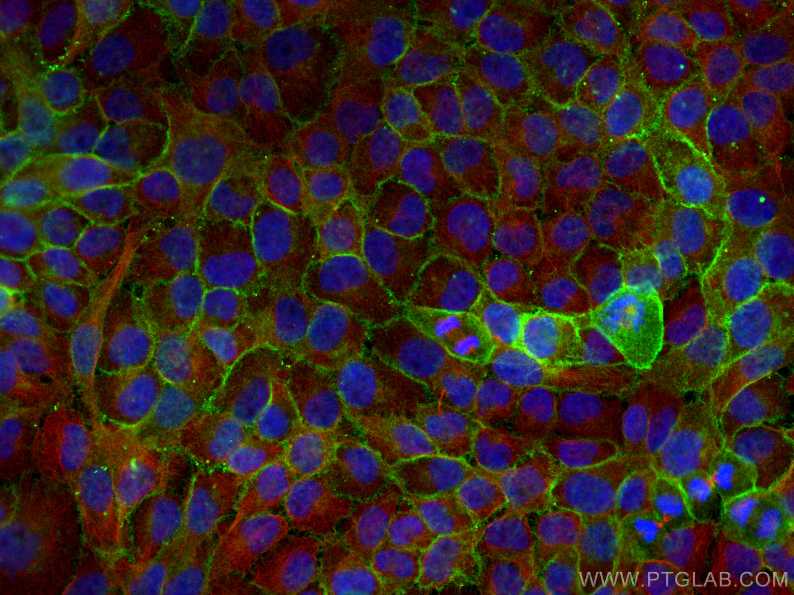 Immunofluorescence (IF) / fluorescent staining of HaCaT cells using DSG3 Polyclonal antibody (29942-1-AP)