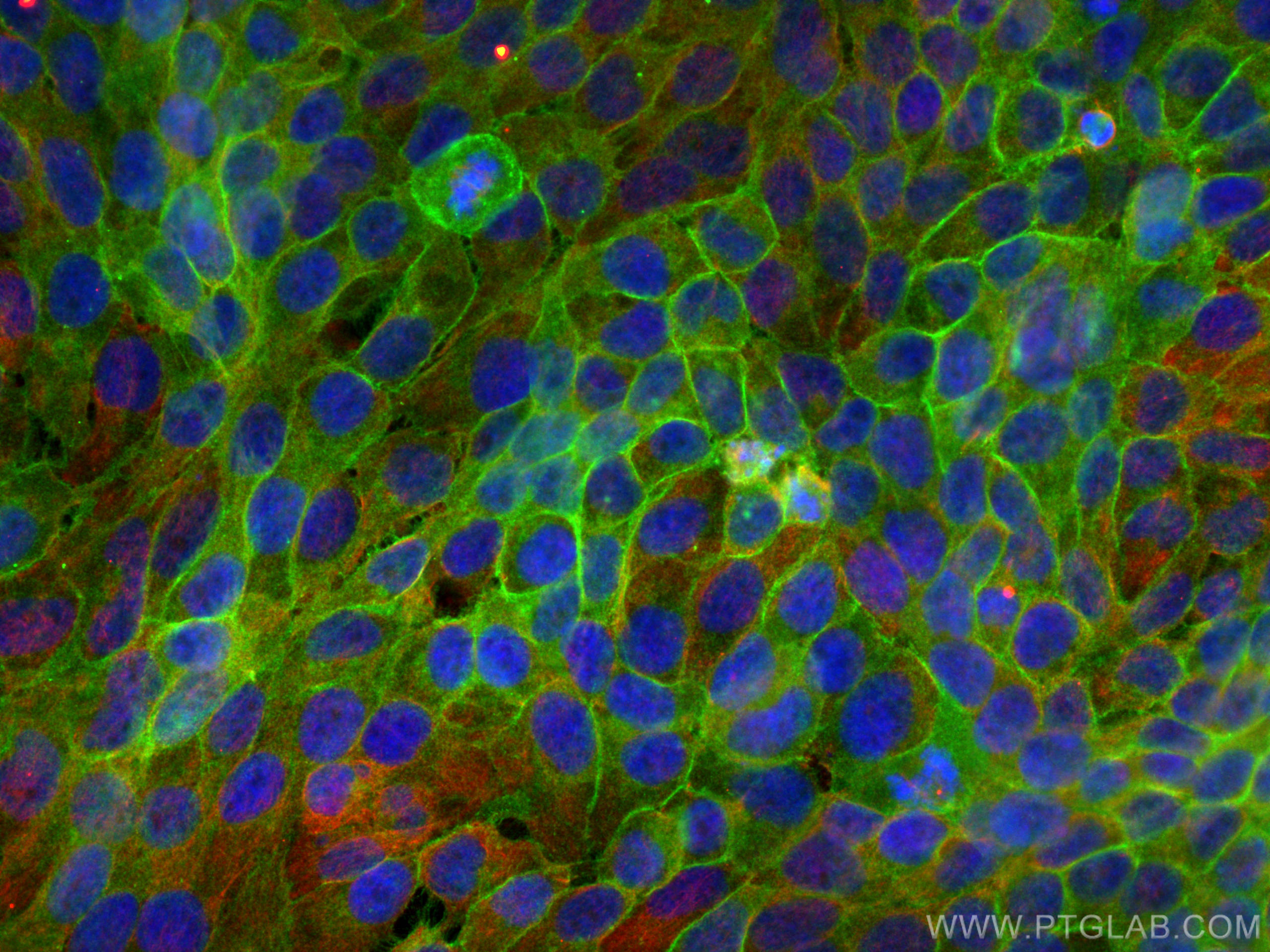 Immunofluorescence (IF) / fluorescent staining of HaCaT cells using DSG3 Polyclonal antibody (29942-1-AP)