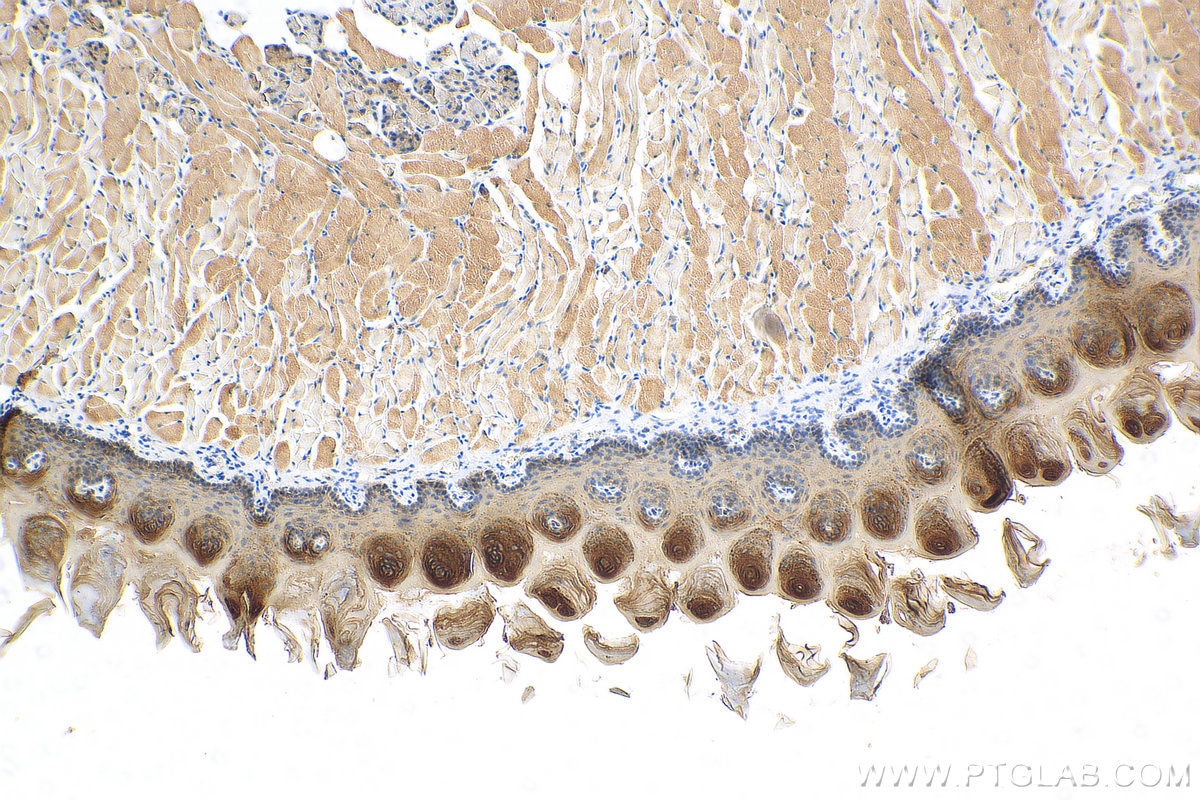 Immunohistochemistry (IHC) staining of mouse tongue tissue using DSG3 Polyclonal antibody (29942-1-AP)