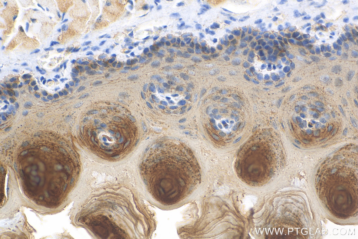 Immunohistochemistry (IHC) staining of mouse tongue tissue using DSG3 Polyclonal antibody (29942-1-AP)