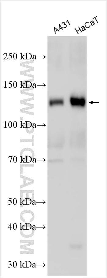 Western Blot (WB) analysis of various lysates using DSG3 Polyclonal antibody (29942-1-AP)