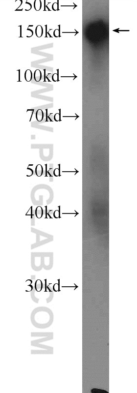 Western Blot (WB) analysis of mouse skin tissue using DSG4 Polyclonal antibody (23087-1-AP)