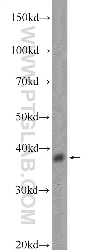 DSN1