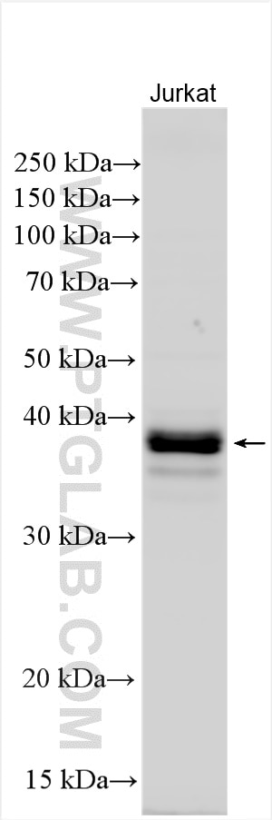 Western Blot (WB) analysis of Jurkat cells using DSN1 Polyclonal antibody (17742-1-AP)
