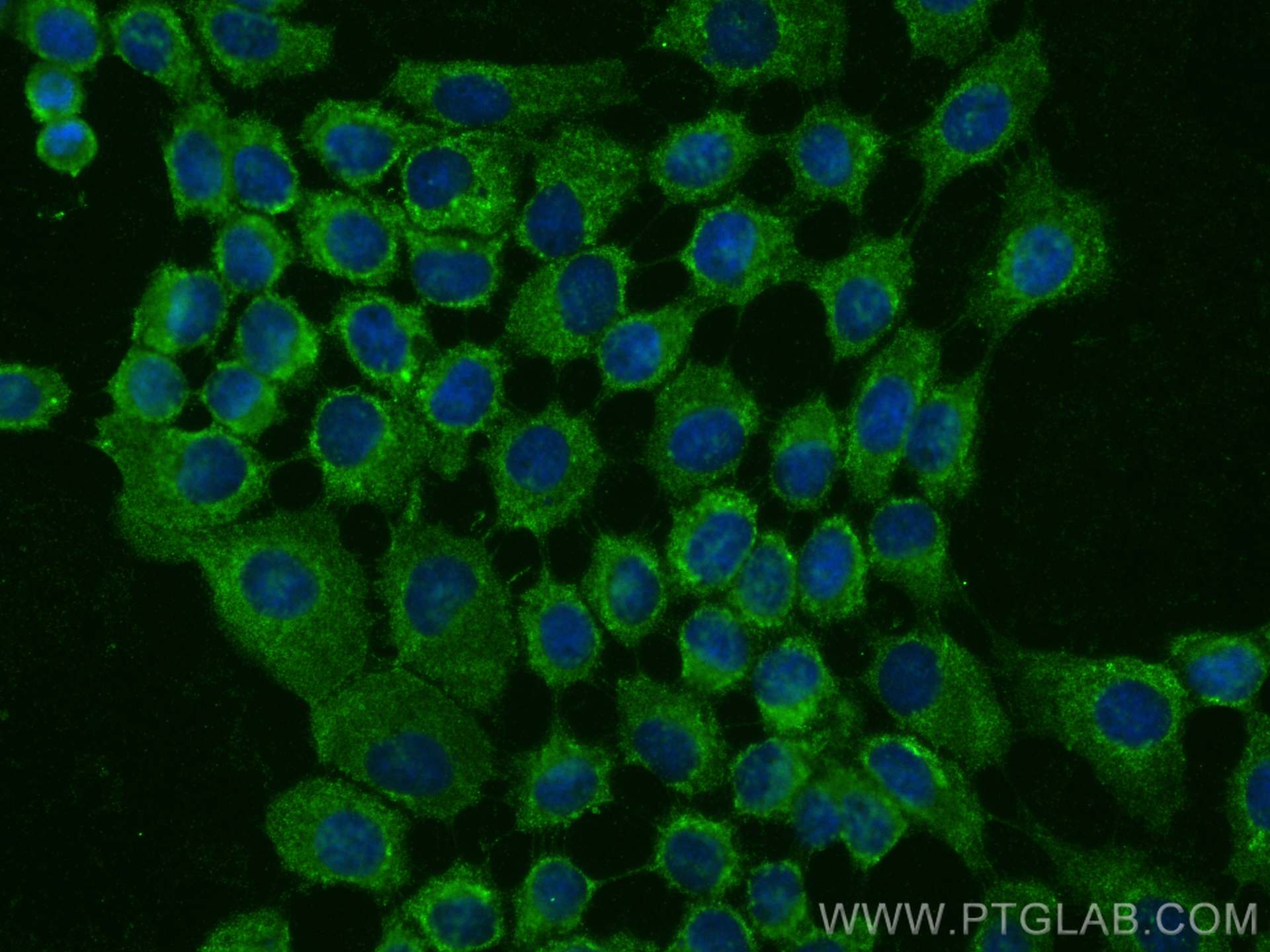 Immunofluorescence (IF) / fluorescent staining of A431 cells using DSP Monoclonal antibody (68364-1-Ig)