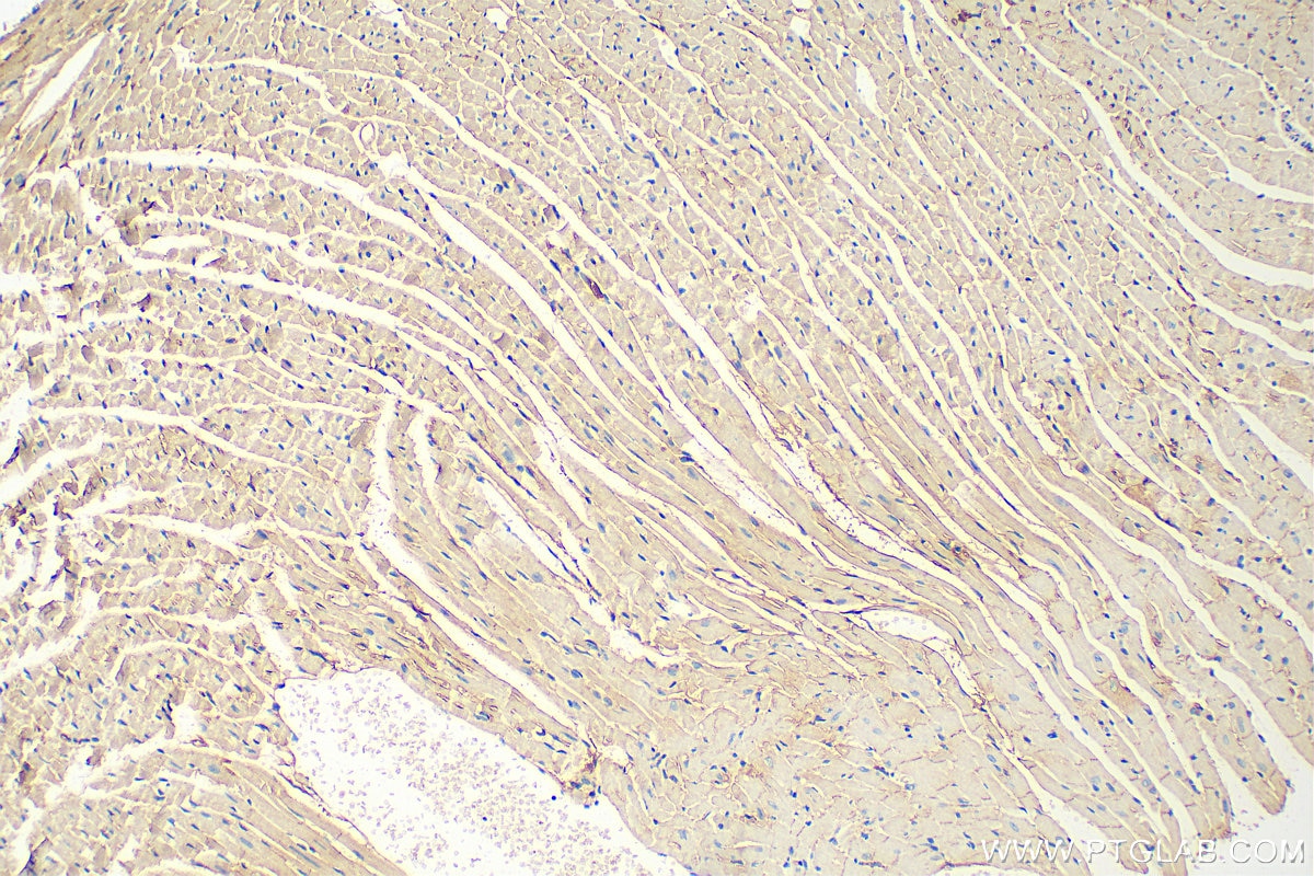 Immunohistochemistry (IHC) staining of mouse heart tissue using DSP Monoclonal antibody (68364-1-Ig)