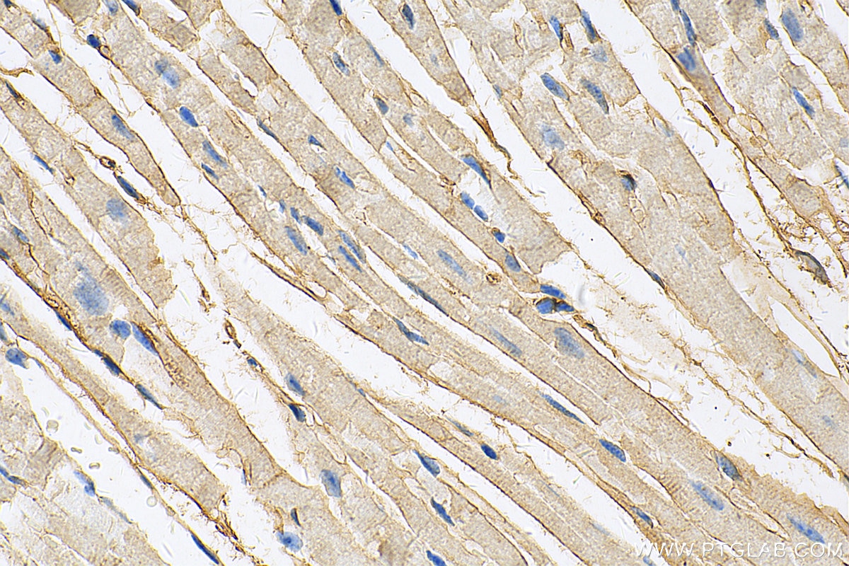 Immunohistochemistry (IHC) staining of mouse heart tissue using DSP Monoclonal antibody (68364-1-Ig)