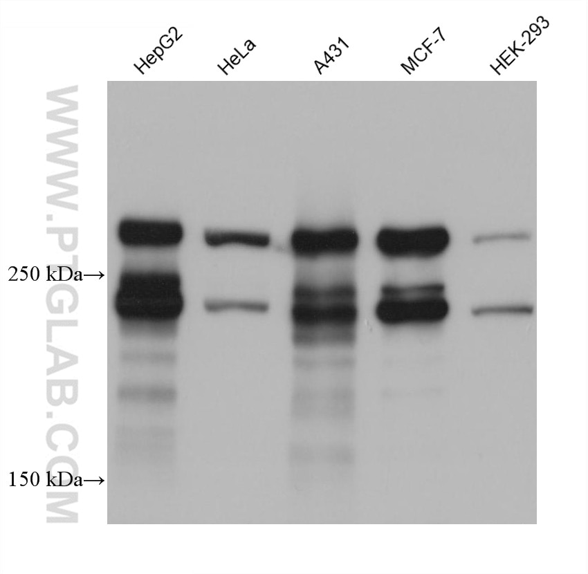 Western Blot (WB) analysis of various lysates using DSP Monoclonal antibody (68364-1-Ig)
