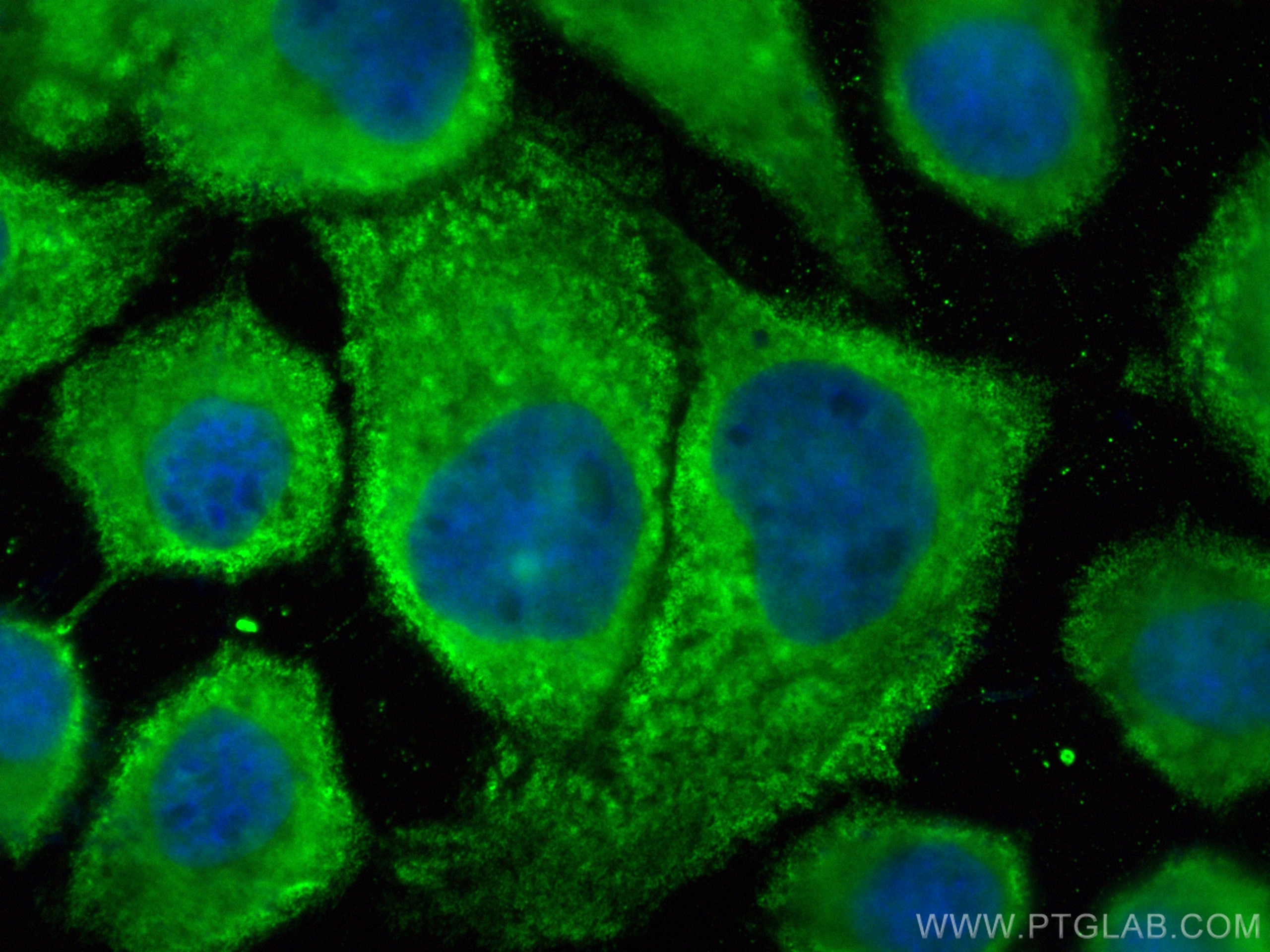 Immunofluorescence (IF) / fluorescent staining of A431 cells using CoraLite® Plus 488-conjugated DSP Monoclonal antib (CL488-68364)