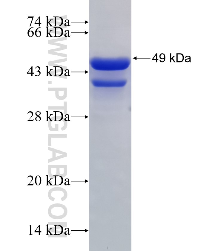 DSP fusion protein Ag30499 SDS-PAGE