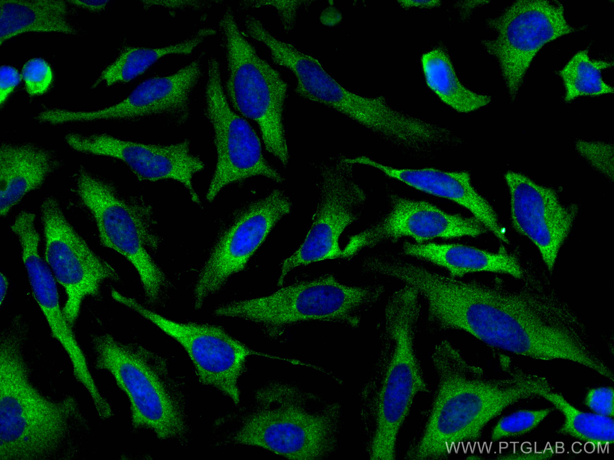 Immunofluorescence (IF) / fluorescent staining of HeLa cells using DSPP Polyclonal antibody (55396-1-AP)