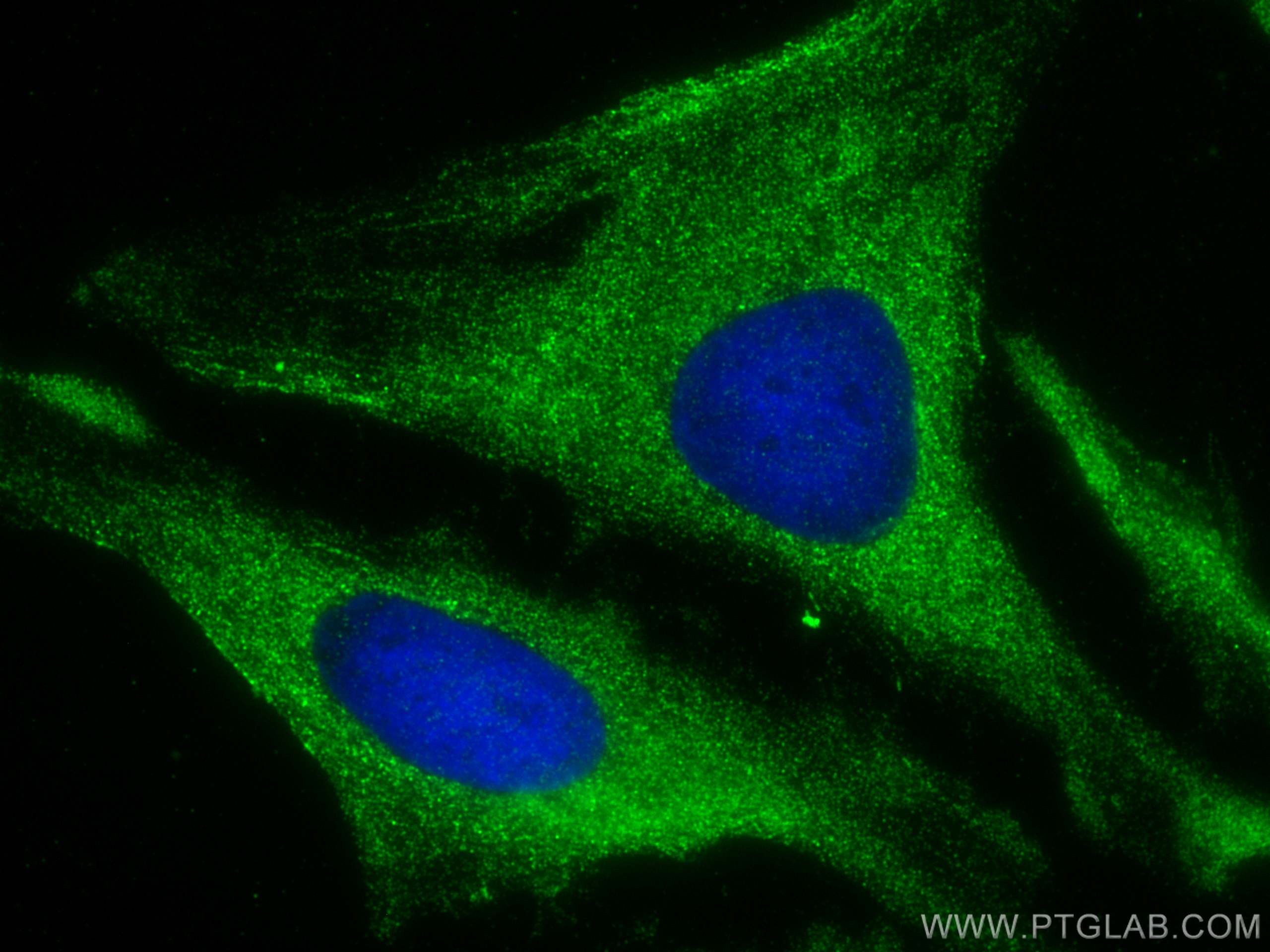 Immunofluorescence (IF) / fluorescent staining of HeLa cells using DSPP Polyclonal antibody (55396-1-AP)