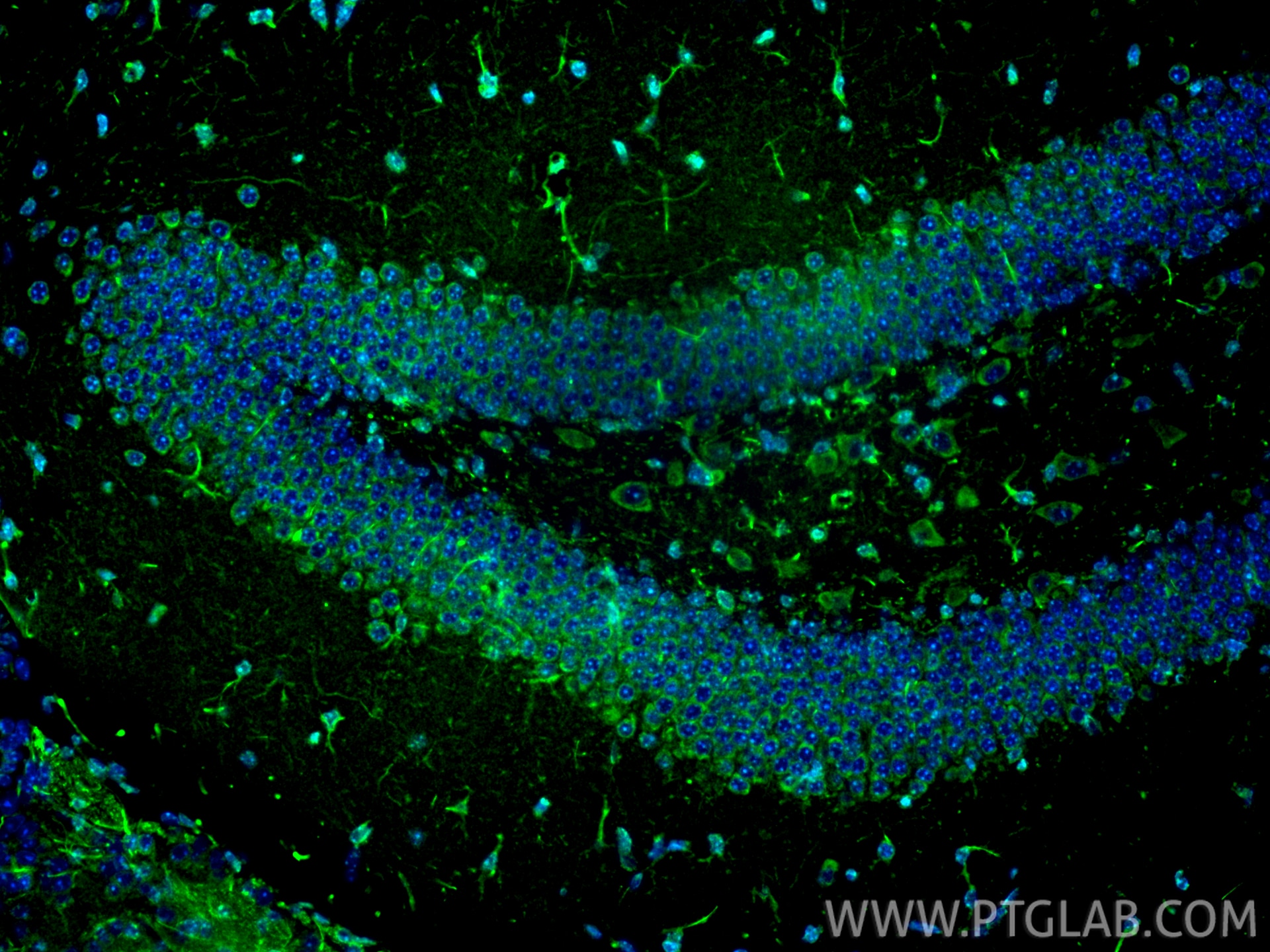 Immunofluorescence (IF) / fluorescent staining of mouse brain tissue using DSPP Polyclonal antibody (55396-1-AP)