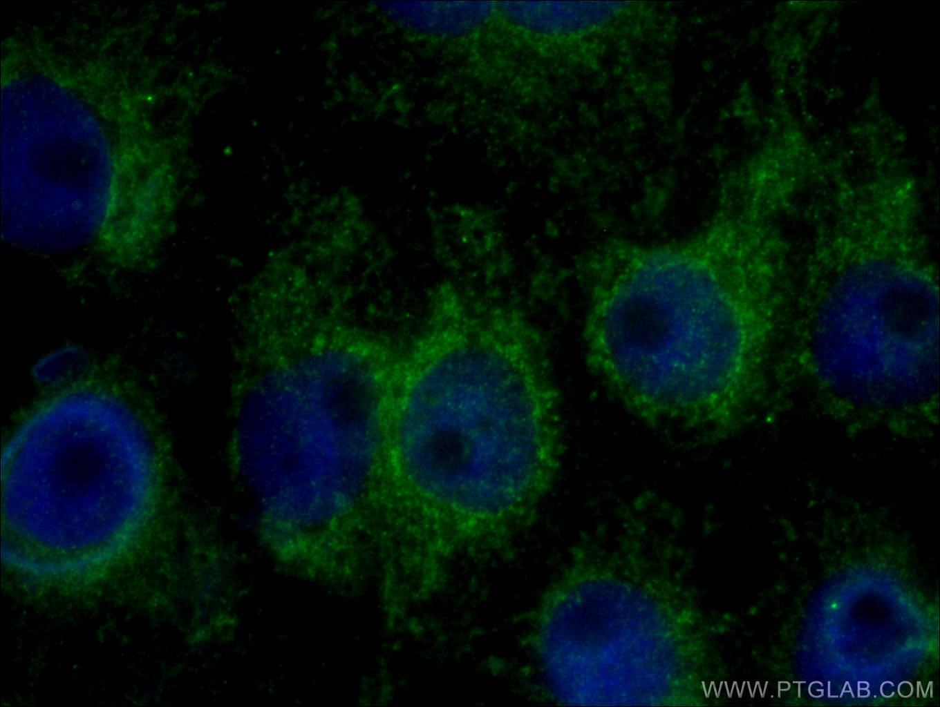 Immunofluorescence (IF) / fluorescent staining of SH-SY5Y cells using DST Polyclonal antibody (28438-1-AP)