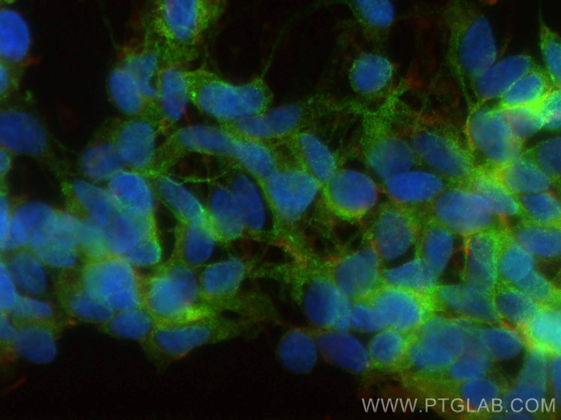Immunofluorescence (IF) / fluorescent staining of SH-SY5Y cells using DST Polyclonal antibody (28438-1-AP)