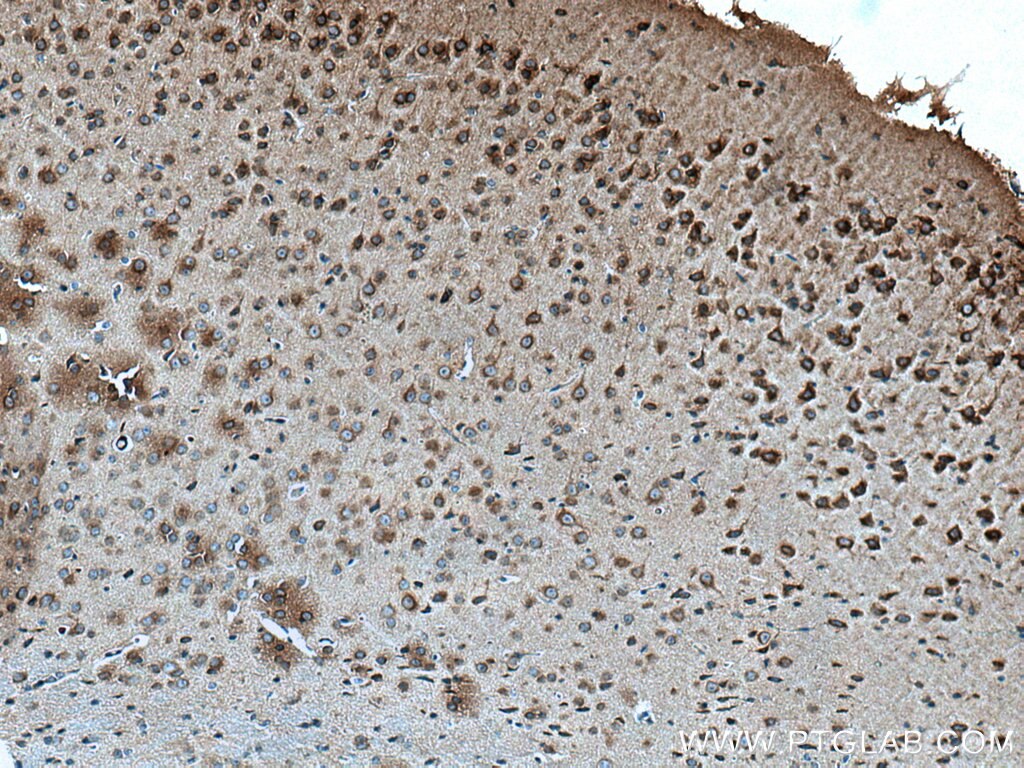 Immunohistochemistry (IHC) staining of mouse brain tissue using DST Polyclonal antibody (28438-1-AP)