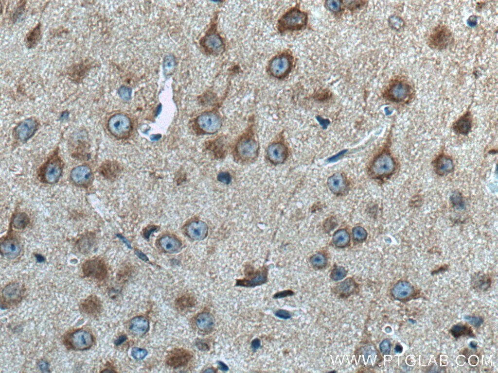 Immunohistochemistry (IHC) staining of mouse brain tissue using DST Polyclonal antibody (28438-1-AP)