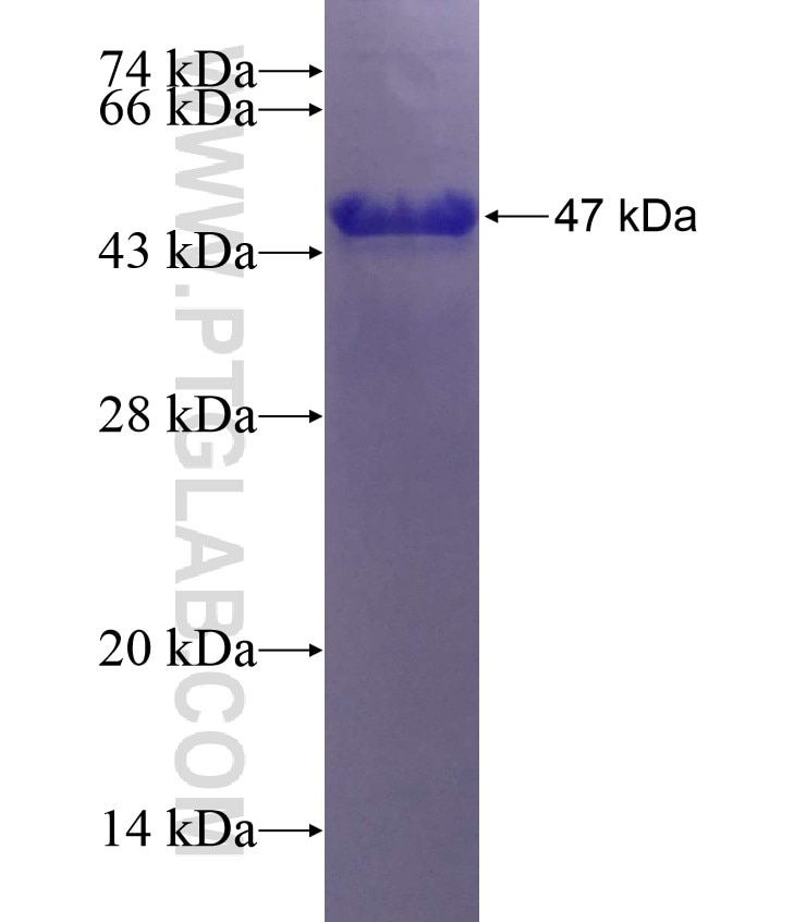 DST fusion protein Ag28833 SDS-PAGE