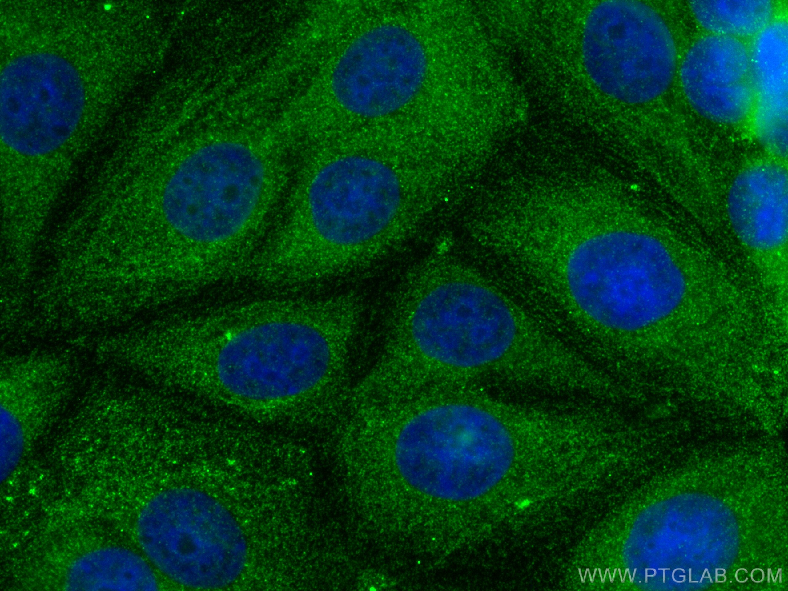 Immunofluorescence (IF) / fluorescent staining of MCF-7 cells using Destrin Polyclonal antibody (10962-2-AP)