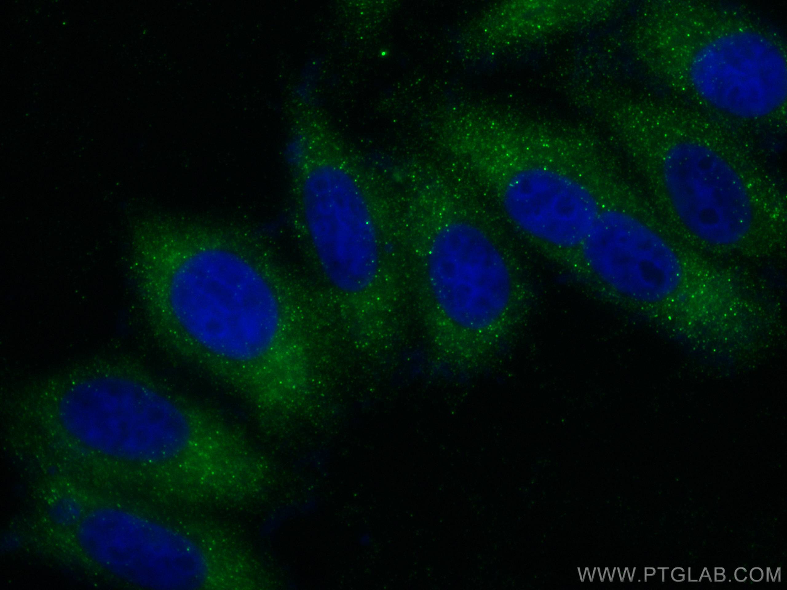Immunofluorescence (IF) / fluorescent staining of HepG2 cells using DSTYK Polyclonal antibody (20102-1-AP)