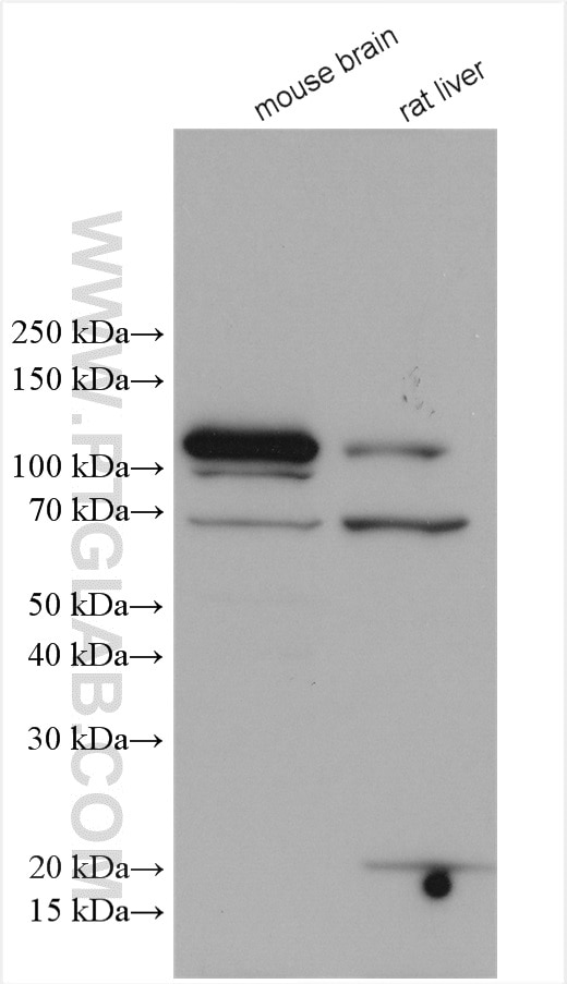 Western Blot (WB) analysis of various lysates using RIPK5 Polyclonal antibody (20102-1-AP)