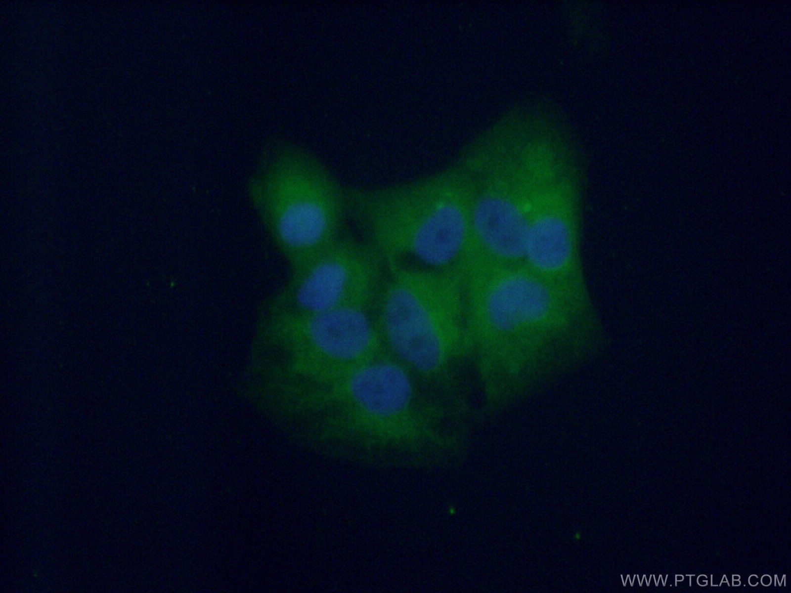 Immunofluorescence (IF) / fluorescent staining of A549 cells using DTD1 Polyclonal antibody (17480-1-AP)